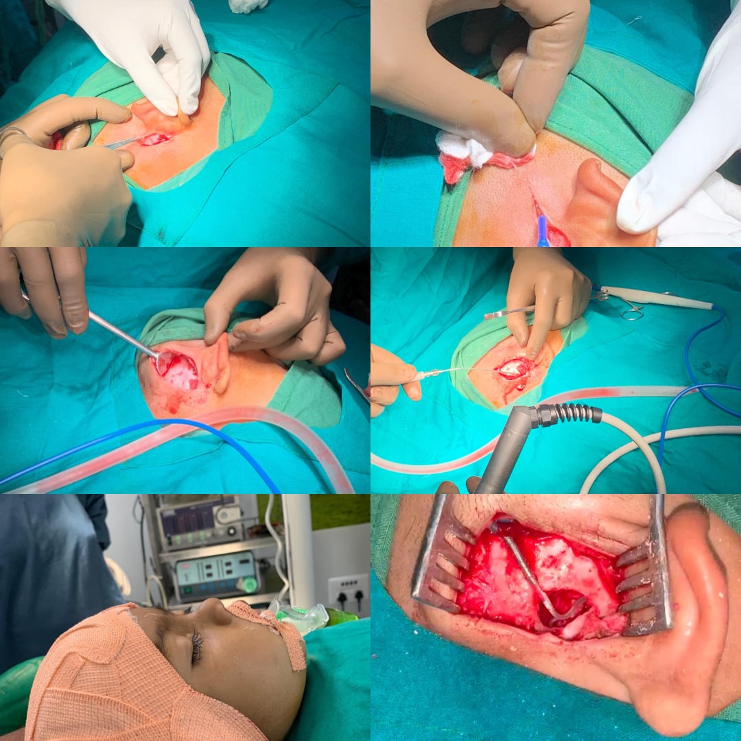 Cochlear Implant Centre